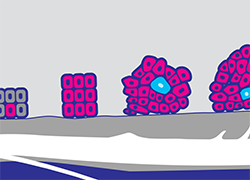 An image showing the stages of cancer initiation in cells