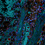 RNA Scope RCC